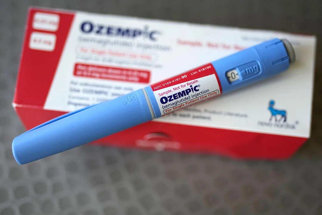Un estudio de UCSF revela que los fármacos GLP-1 para adelgazar pueden causar pérdida de cabello
