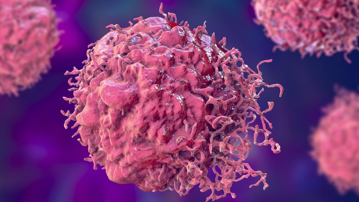 Científicos chinos construyen un detector de cáncer portátil con una precisión del 94,9 % en ensayos